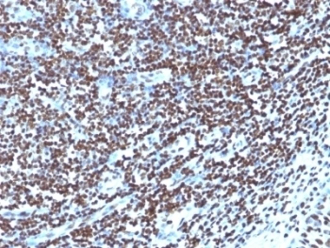 Formalin-fixed, paraffin-embedded human tonsil stained with Histone antibody (1415-1)