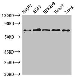 Western Blot. Positive WB detected in: HepG2 whole cell lysate, A549 whole cell lysate, HEK293 whole cell lysate, Rat heart tissue, Rat lung tissue. All lanes: EIF2AK1 antibody at 3ug/ml. Secondary. Goat polyclonal to rabbit IgG at 1/50000 dilution. Predicted band size: 72 kDa. Observed band size: 72 kDa.