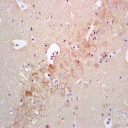 Paraffin-embedded rat brain tissue fixed with 4% paraformaldehyde. Antigen retrieval by boiling with citrate buffer. Blocking buffer is goat serum (37 degrees for 20 min.). IRAK4 (phospho-Thr345) antibody at 1:200 dilution with overnight incubation at 4 d