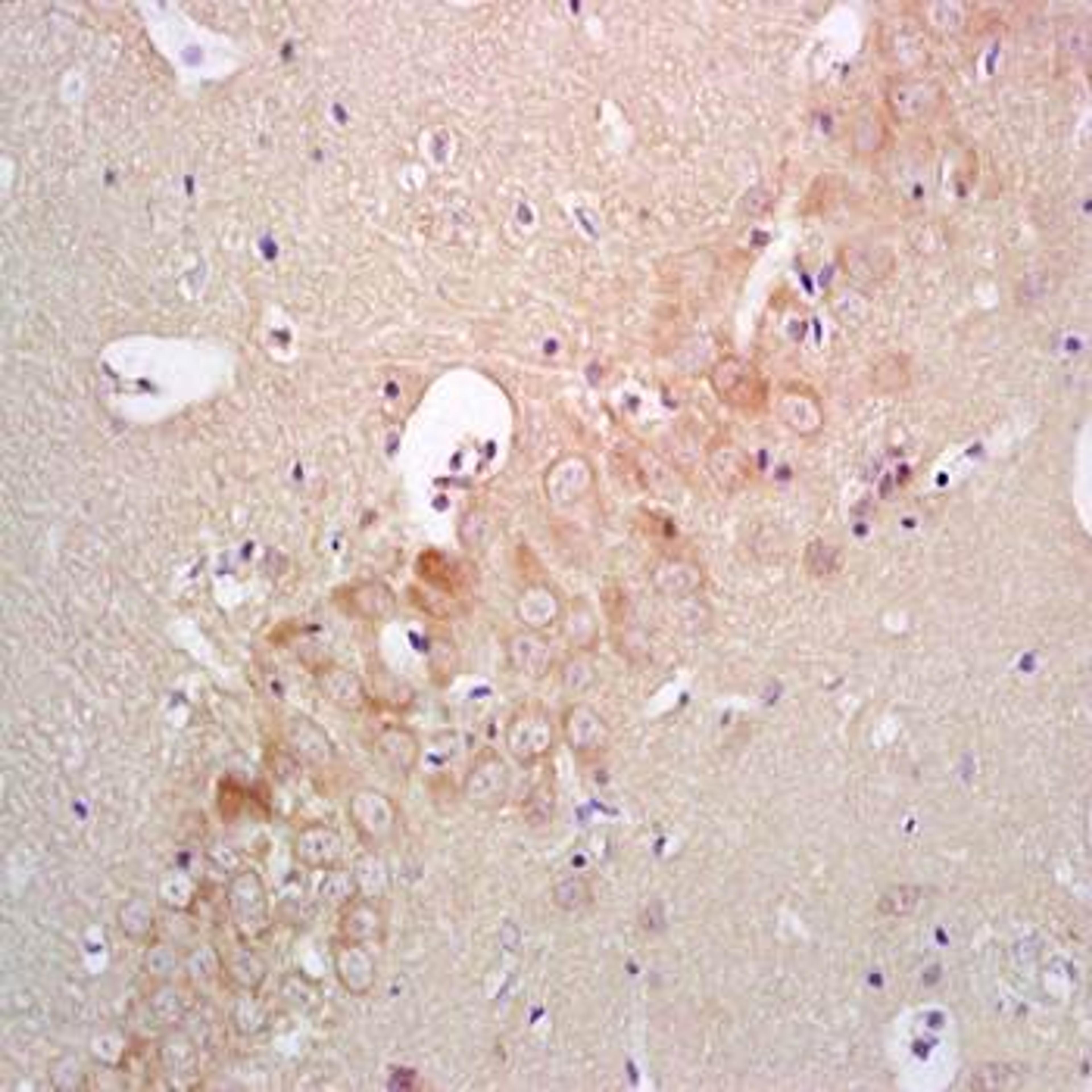 Paraffin-embedded rat brain tissue fixed with 4% paraformaldehyde. Antigen retrieval by boiling with citrate buffer. Blocking buffer is goat serum (37 degrees for 20 min.). IRAK4 (phospho-Thr345) antibody at 1:200 dilution with overnight incubation at 4 d