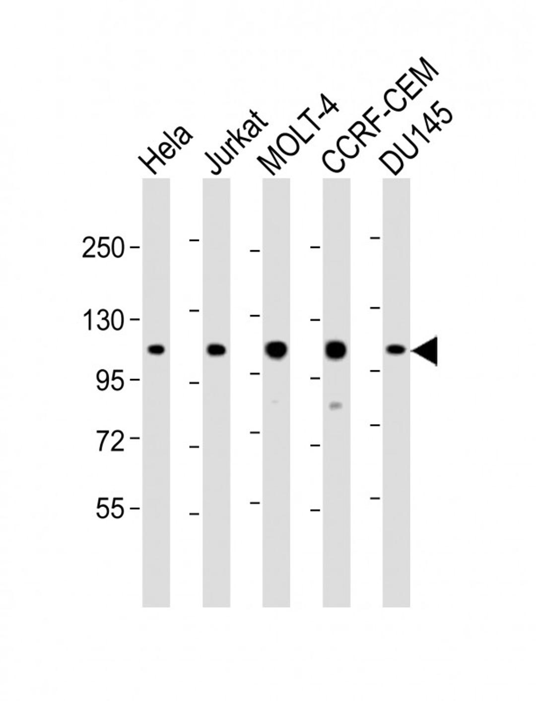 Western Blot at 1:2000 dilution Lane 1: Hela whole cell lysate Lane 2: Jurkat whole cell lysate Lane 3: MOLT-4 whole cell lysate Lane 4: CCRF-CEM whole cell lysate Lane 5: DU145 whole cell lysate Lysates/proteins at 20 ug per lane.