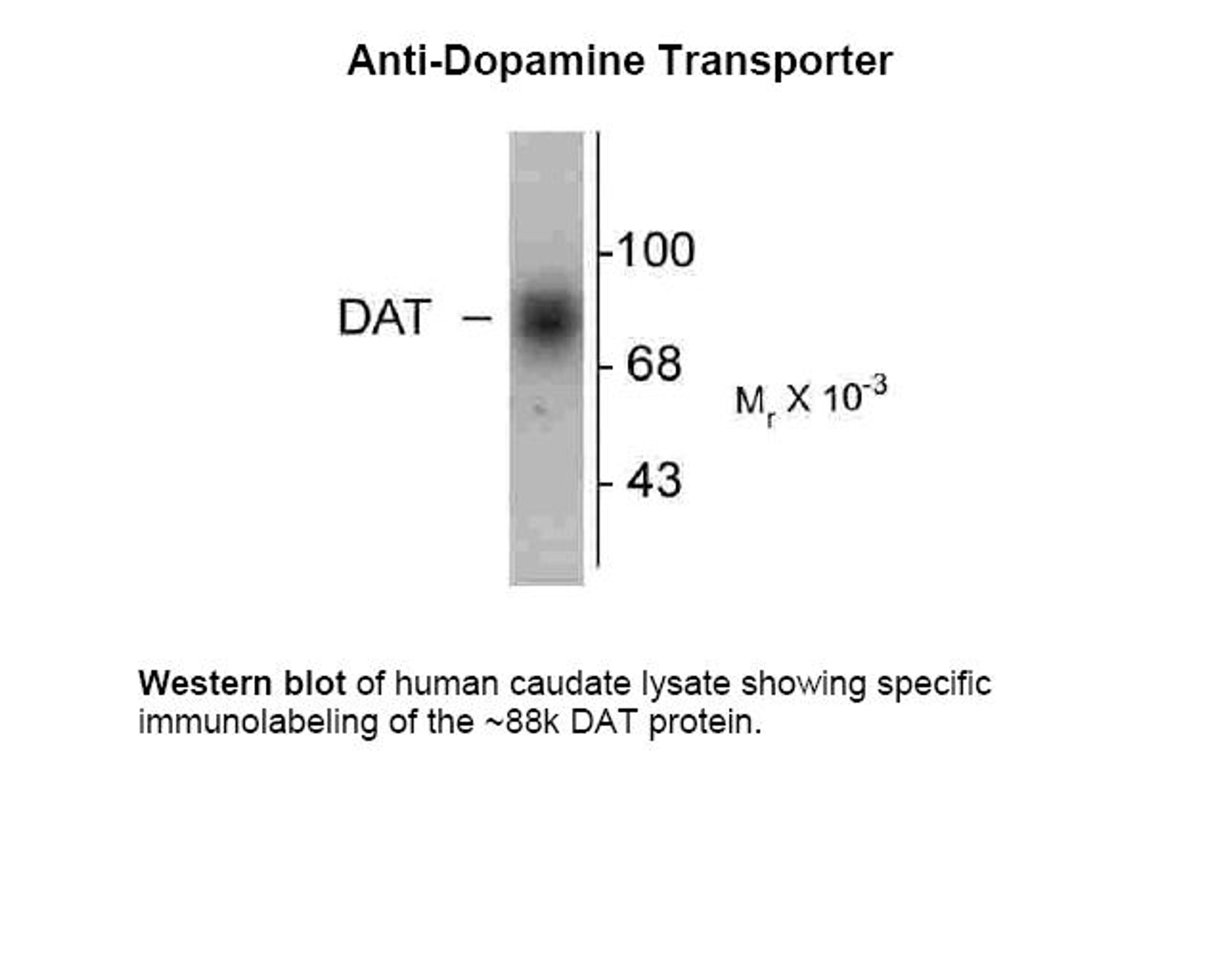 Western blot of human caudate lysate showing specific immunolabeling of the ~88k DAT protein.