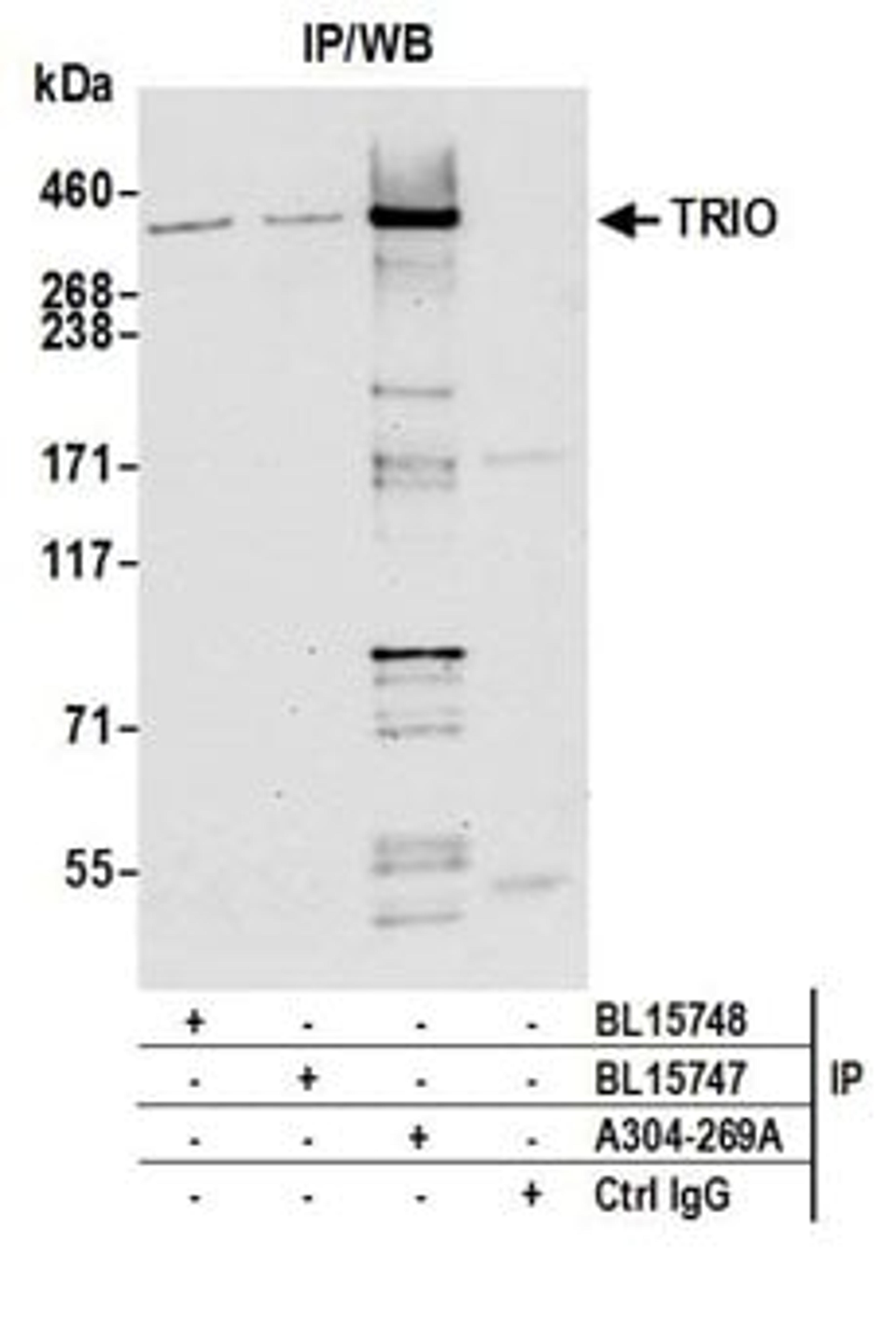 Detection of human TRIO by western blot of immunoprecipitates.