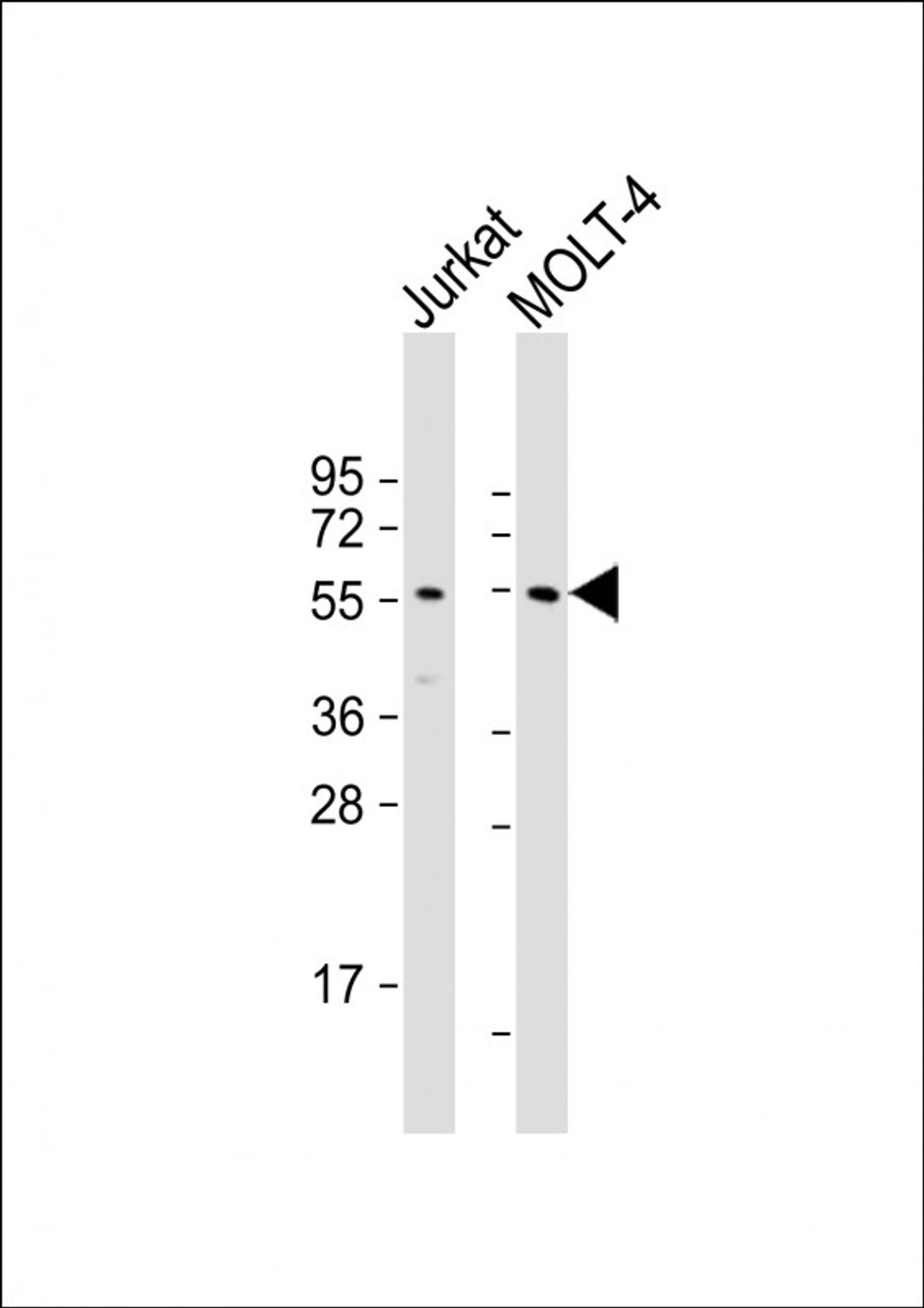 Western Blot at 1:1000 dilution Lane 1: Jurkat whole cell lysate Lane 2: MOLT-4 whole cell lysate Lysates/proteins at 20 ug per lane.