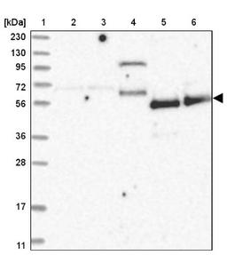 Western Blot: ZNF543 Antibody [NBP1-85122] - Lane 1: Marker [kDa] 230, 130, 95, 72, 56, 36, 28, 17, 11<br/>Lane 2: Human cell line RT-4<br/>Lane 3: Human cell line U-251MG sp<br/>Lane 4: Human plasma (IgG/HSA depleted)<br/>Lane 5: Human liver tissue<br/>Lane 6: Human tonsil tissue