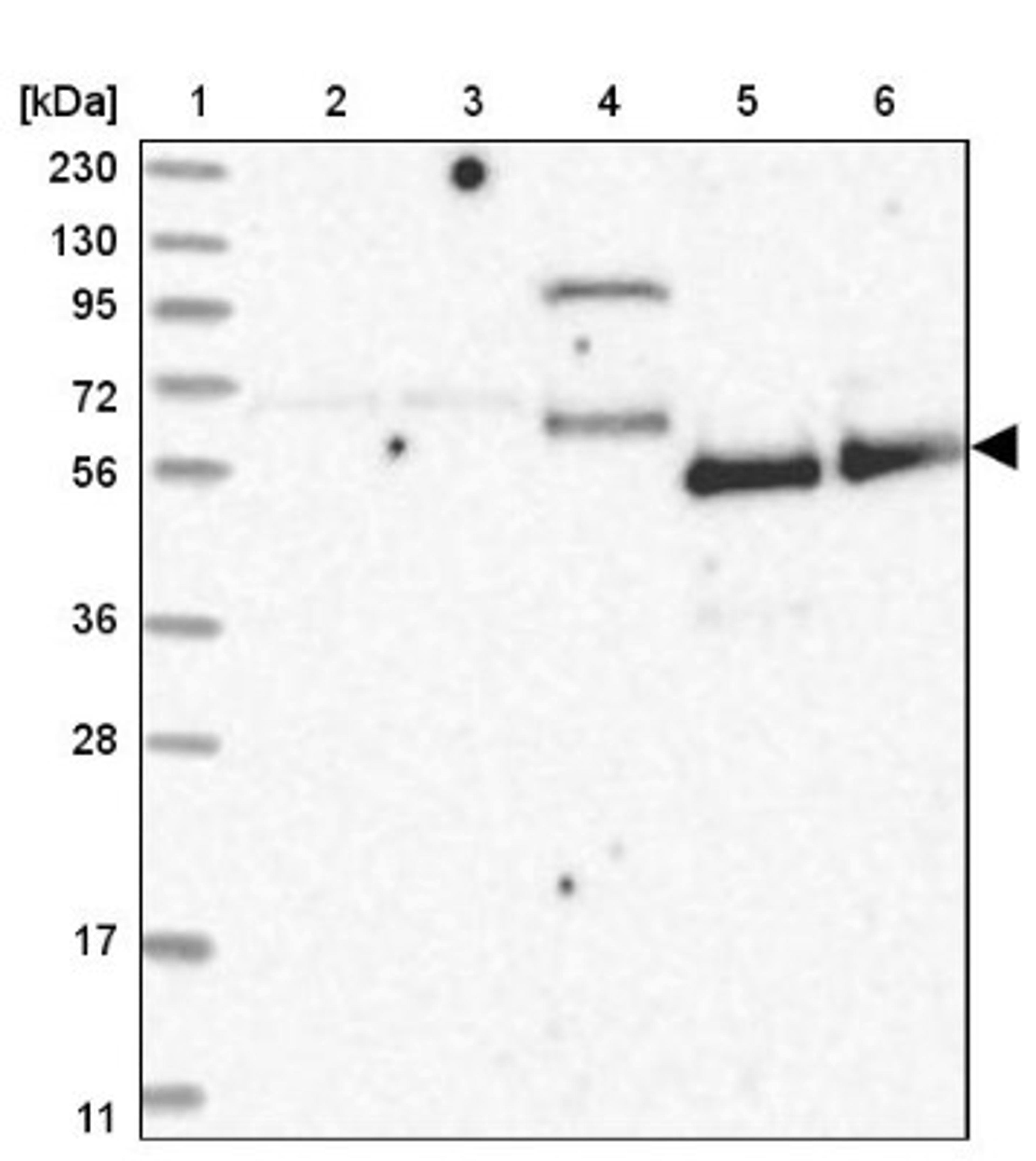 Western Blot: ZNF543 Antibody [NBP1-85122] - Lane 1: Marker [kDa] 230, 130, 95, 72, 56, 36, 28, 17, 11<br/>Lane 2: Human cell line RT-4<br/>Lane 3: Human cell line U-251MG sp<br/>Lane 4: Human plasma (IgG/HSA depleted)<br/>Lane 5: Human liver tissue<br/>Lane 6: Human tonsil tissue