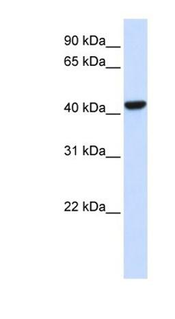 Western Blot: Cystathionase Antibody [NBP1-52849] - Transfected 293T cell lysate, concentration 0.2-1 ug/ml.