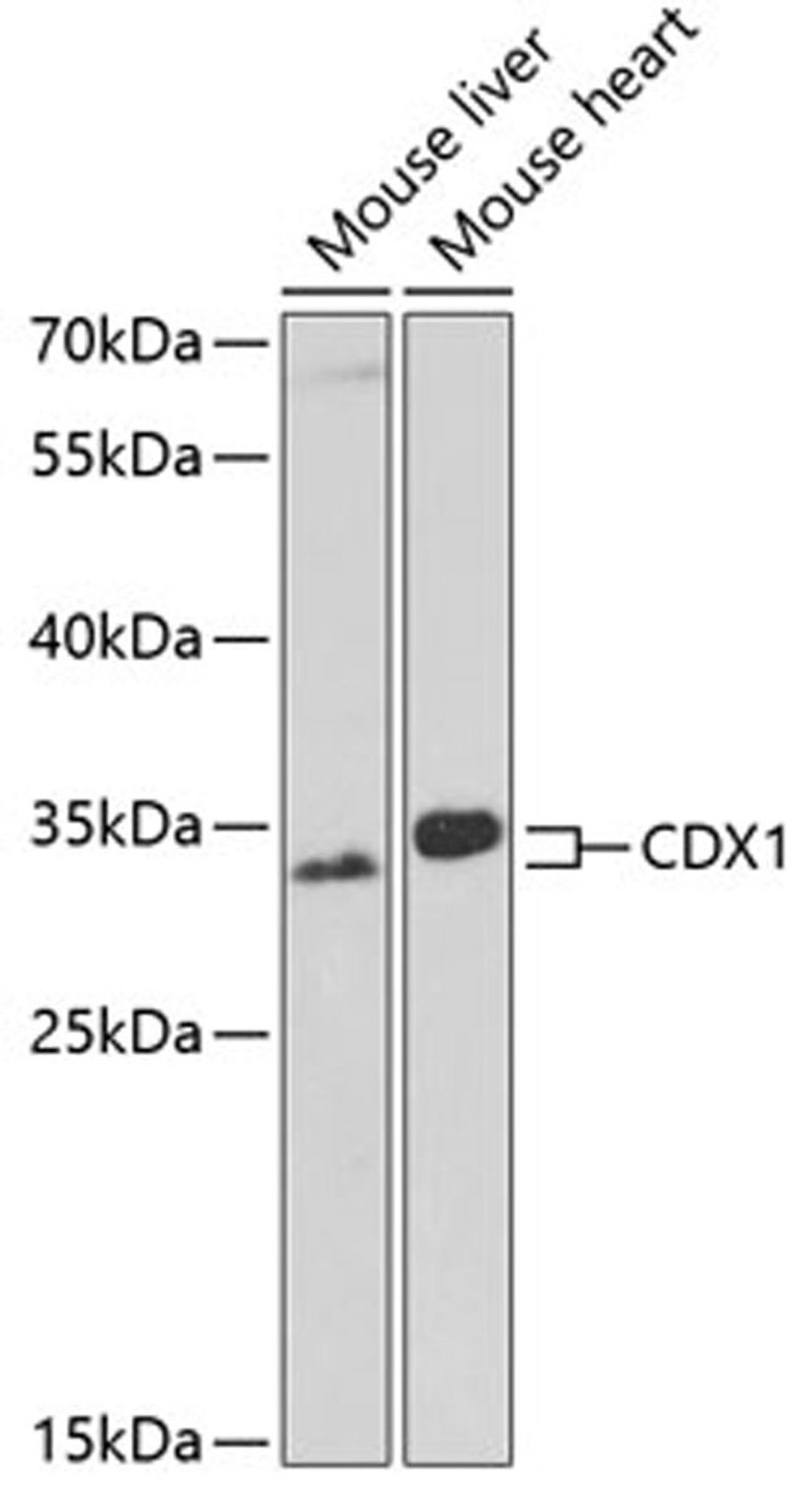 Western blot - CDX1 antibody (A5712)