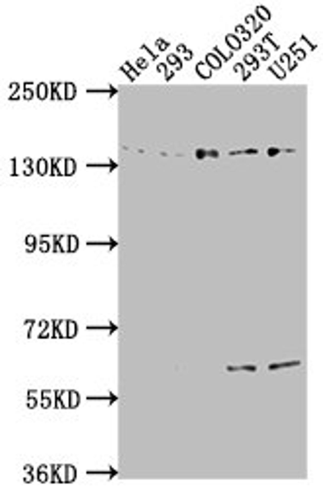 Western Blot. Positive WB detected in: Hela whole cell lysate, 293 whole cell lysate, COLO320 whole cell lysate, 293T whole cell lysate, U251 whole cell lysate. All lanes: ERC1 antibody at 1:2000. Secondary. Goat polyclonal to rabbit IgG at 1/50000 dilution. Predicted band size: 129, 114, 125, 109, 82 kDa. Observed band size: 135 kDa. 