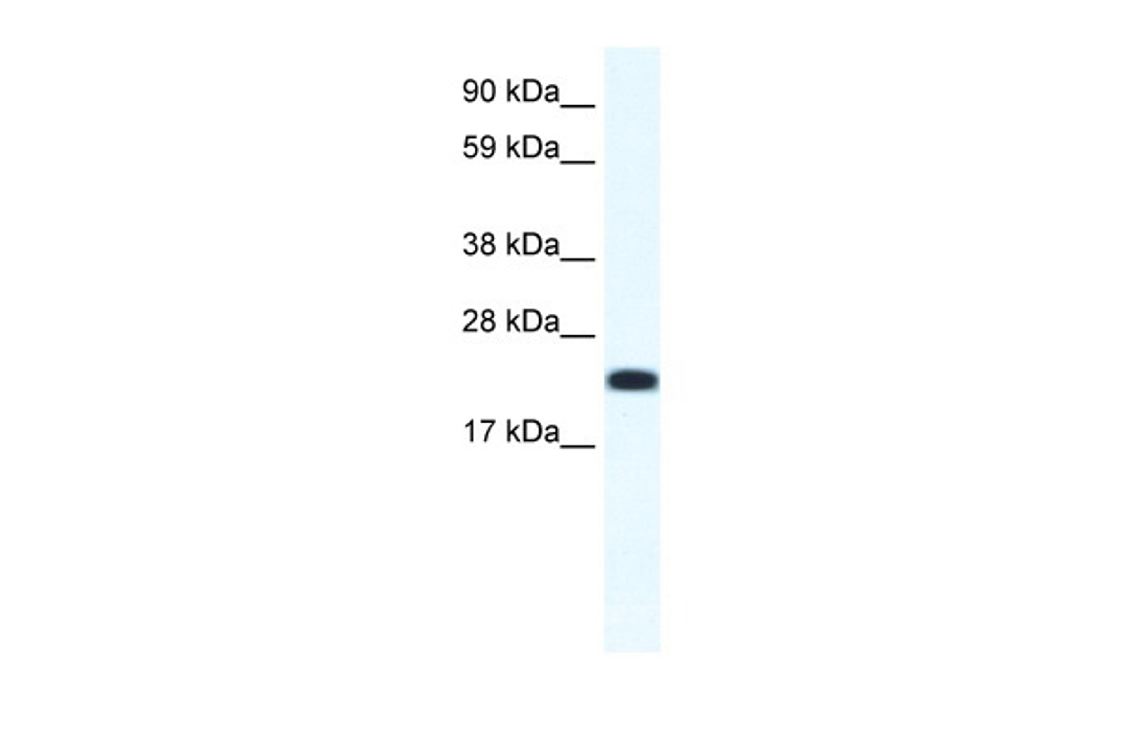 Antibody used in WB on Mouse SP2/0 at 1.25 ug/ml.