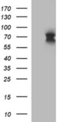 Western Blot: IL6R Antibody (2F4) [NBP2-45414] - Analysis of HEK293T cells were transfected with the pCMV6-ENTRY control (Left lane) or pCMV6-ENTRY IL6R.