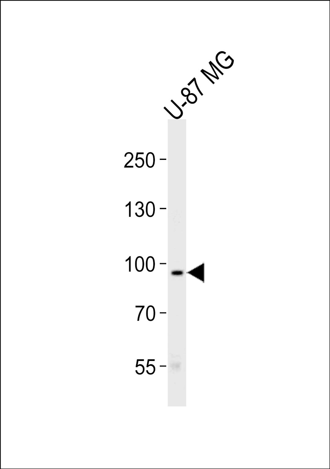 Western blot analysis of lysate from U-87 MG cell line, using TYRO3 Antibody at 1:1000 at each lane.