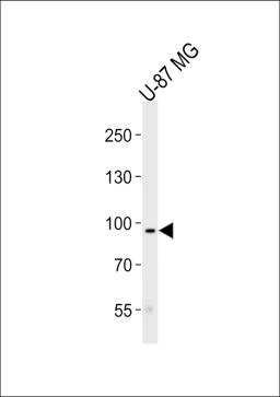 Western blot analysis of lysate from U-87 MG cell line, using TYRO3 Antibody at 1:1000 at each lane.