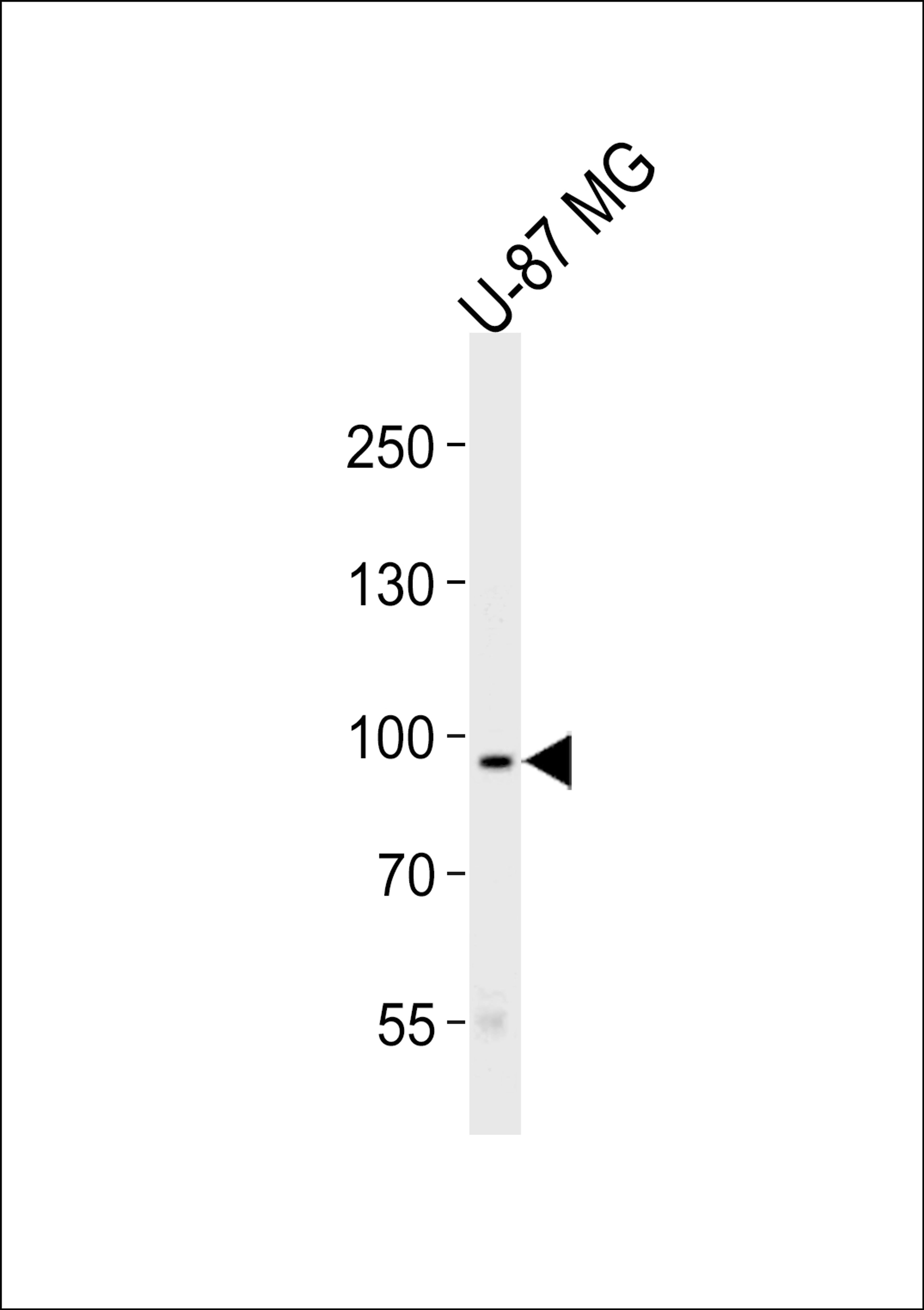 Western blot analysis of lysate from U-87 MG cell line, using TYRO3 Antibody at 1:1000 at each lane.