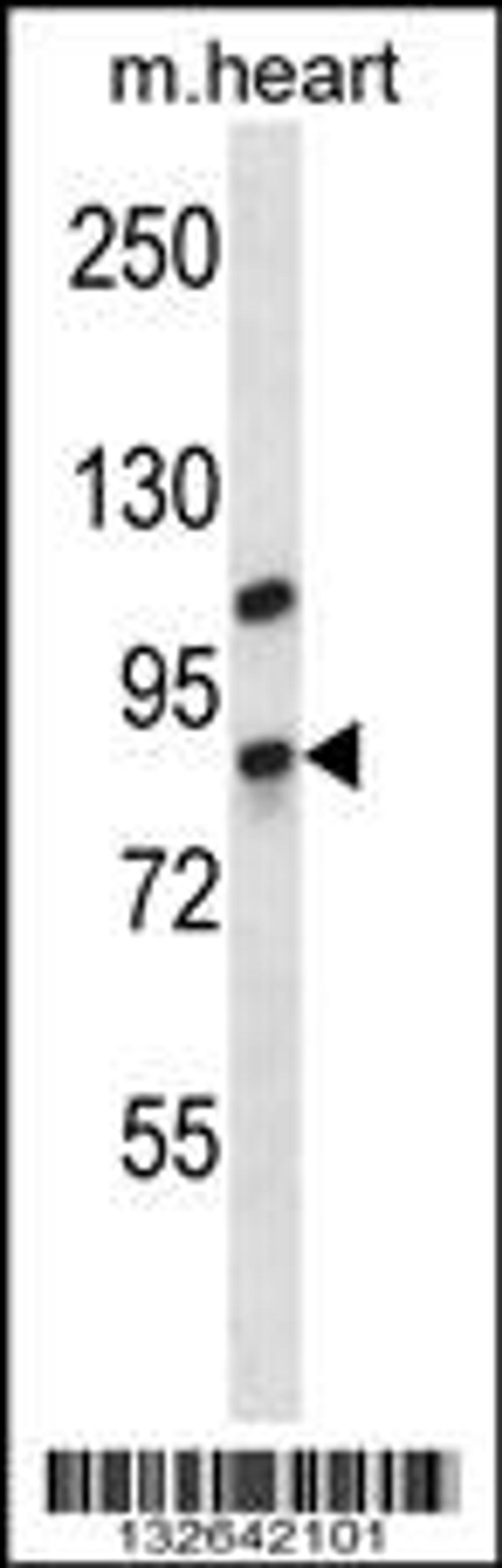 Western blot analysis in mouse heart tissue lysates (35ug/lane).