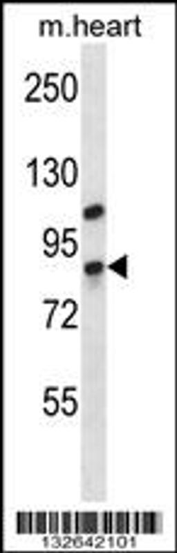 Western blot analysis in mouse heart tissue lysates (35ug/lane).