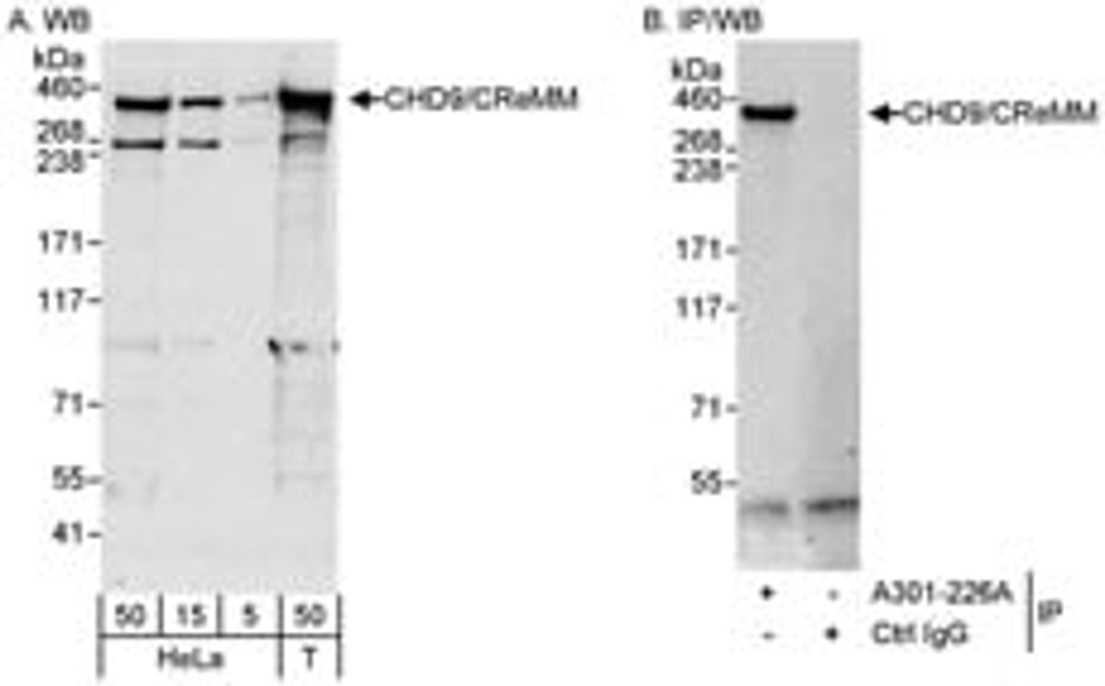 Detection of human CHD9/CReMM by western blot and immunoprecipitation.