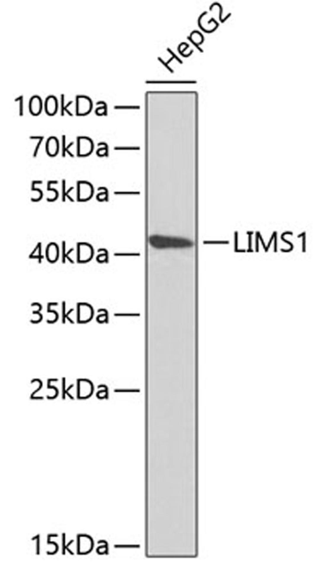 Western blot - LIMS1 antibody (A6384)