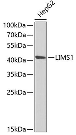 Western blot - LIMS1 antibody (A6384)