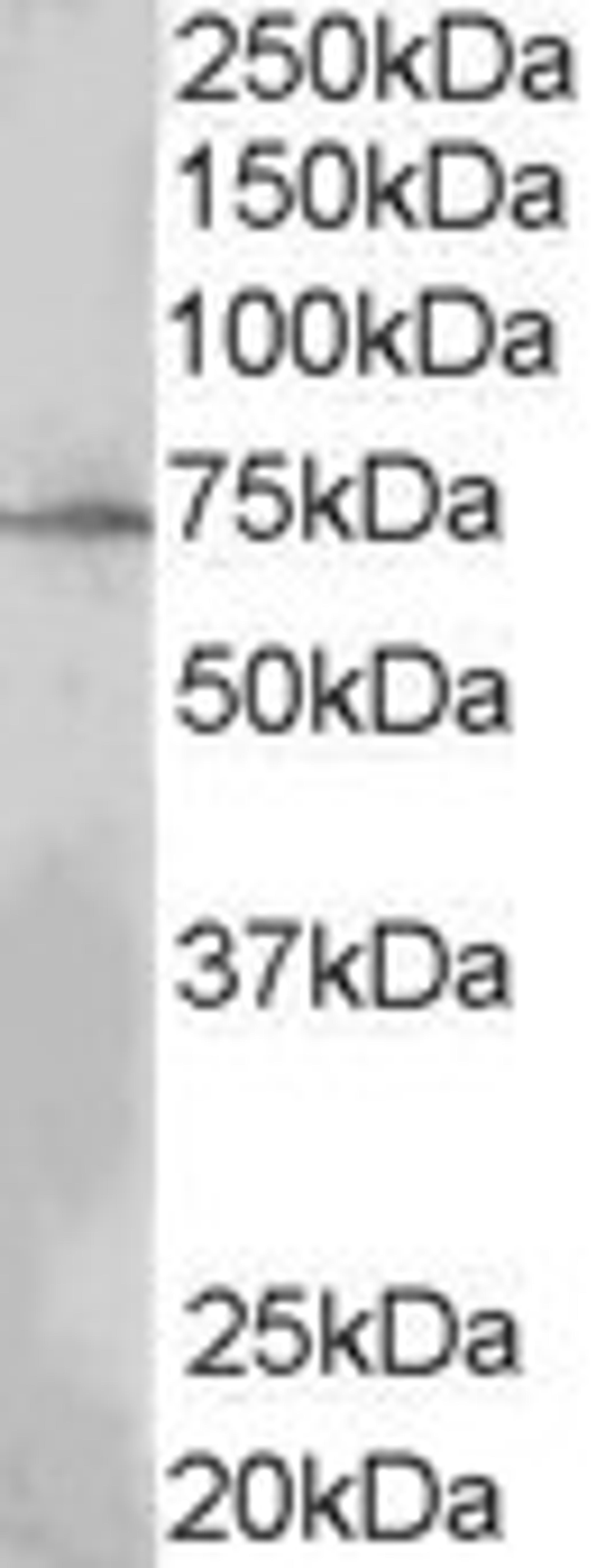 45-844 (0.3ug/ml) staining of MOLT4 lysate (35ug protein in RIPA buffer). Primary incubation was 1 hour. Detected by chemiluminescence.