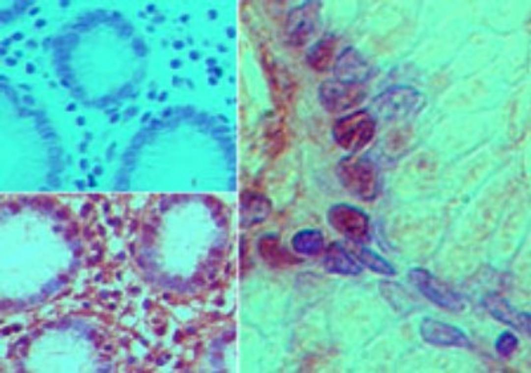 Immunohistochemistry-Paraffin: Nurim Antibody [NB100-56414] - Analysis of Nurim in formalin-fixed, paraffin-embedded human stomach tissue using an isotype control (top left) and Nurim antibody (bottom left, right) at 5 ug/ml.