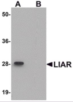 Western blot analysis of LIAR in mouse kidney tissue lysate with LIAR antibody at 1 &#956;g/mL in (A) the absence and (B) the presence of blocking peptide.