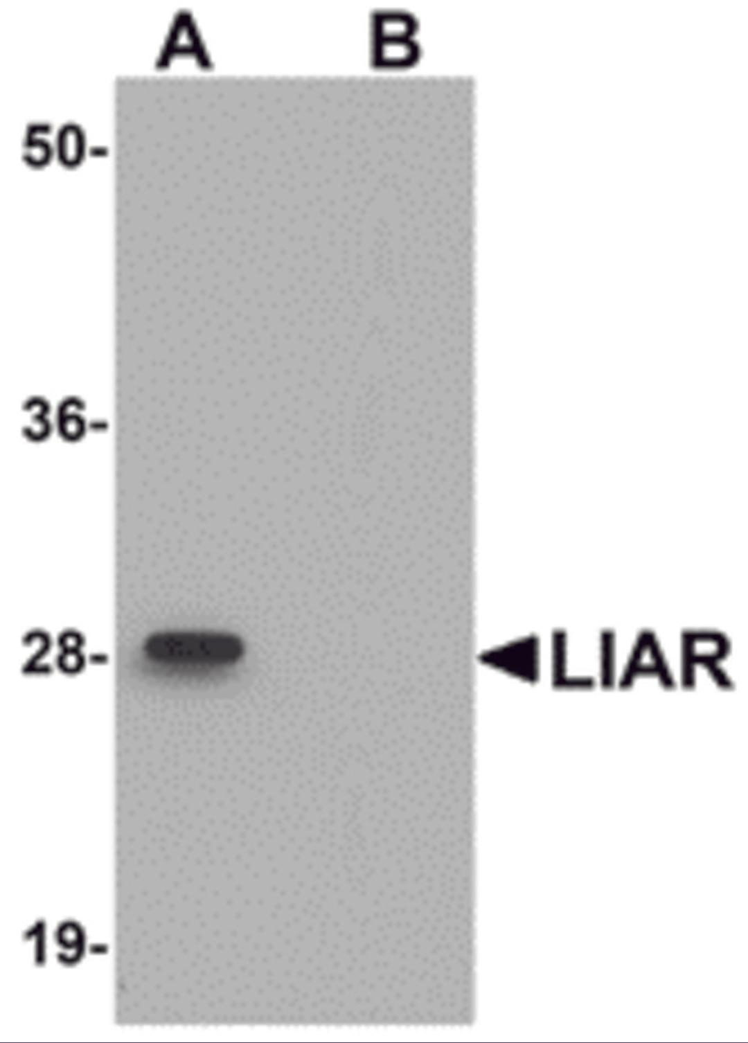 Western blot analysis of LIAR in mouse kidney tissue lysate with LIAR antibody at 1 μg/mL in (A) the absence and (B) the presence of blocking peptide.