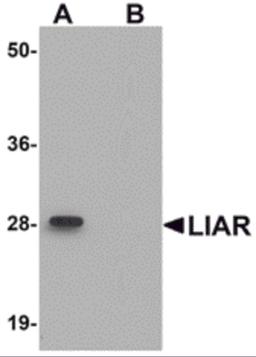 Western blot analysis of LIAR in mouse kidney tissue lysate with LIAR antibody at 1 μg/mL in (A) the absence and (B) the presence of blocking peptide.