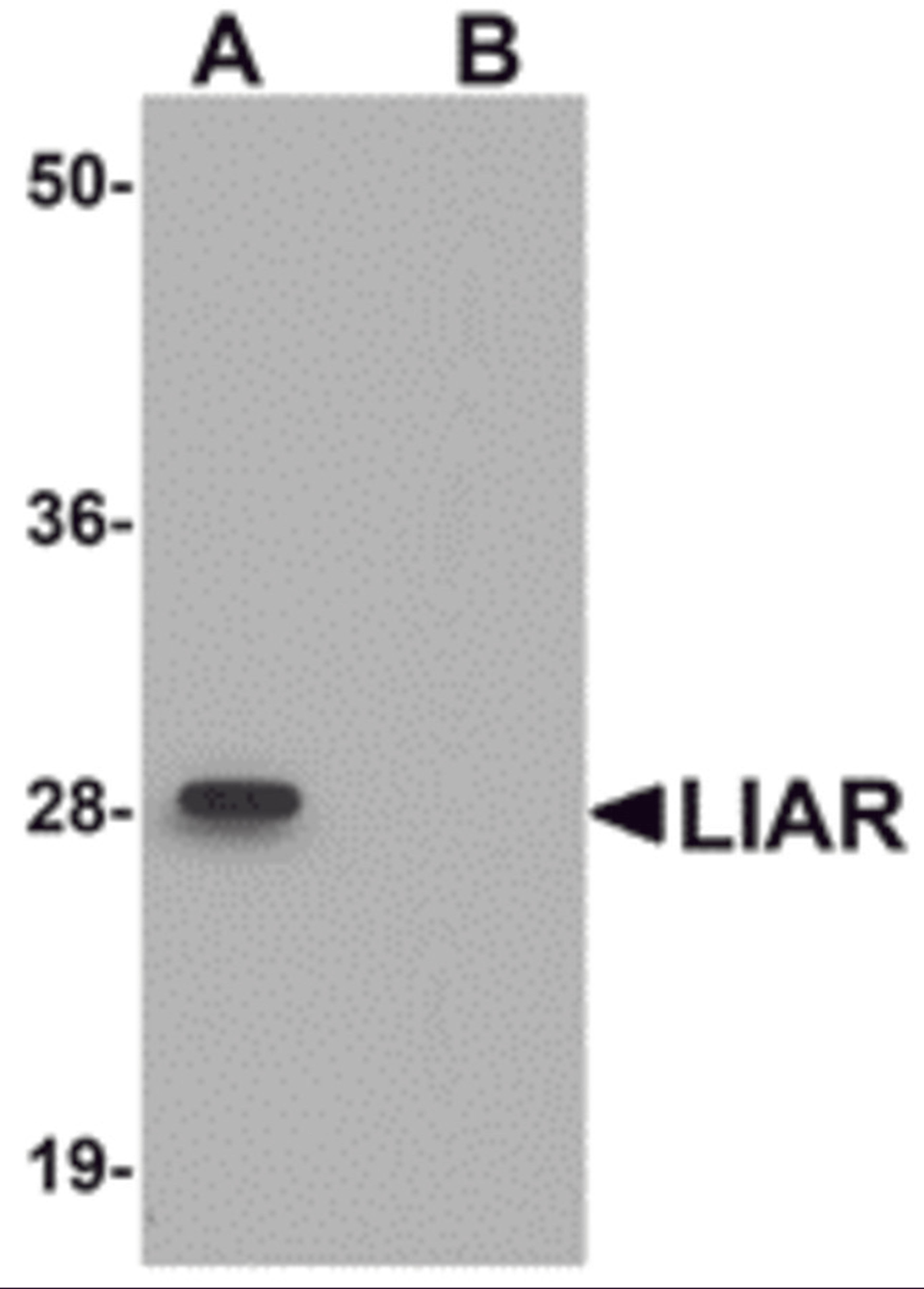 Western blot analysis of LIAR in mouse kidney tissue lysate with LIAR antibody at 1 μg/mL in (A) the absence and (B) the presence of blocking peptide.