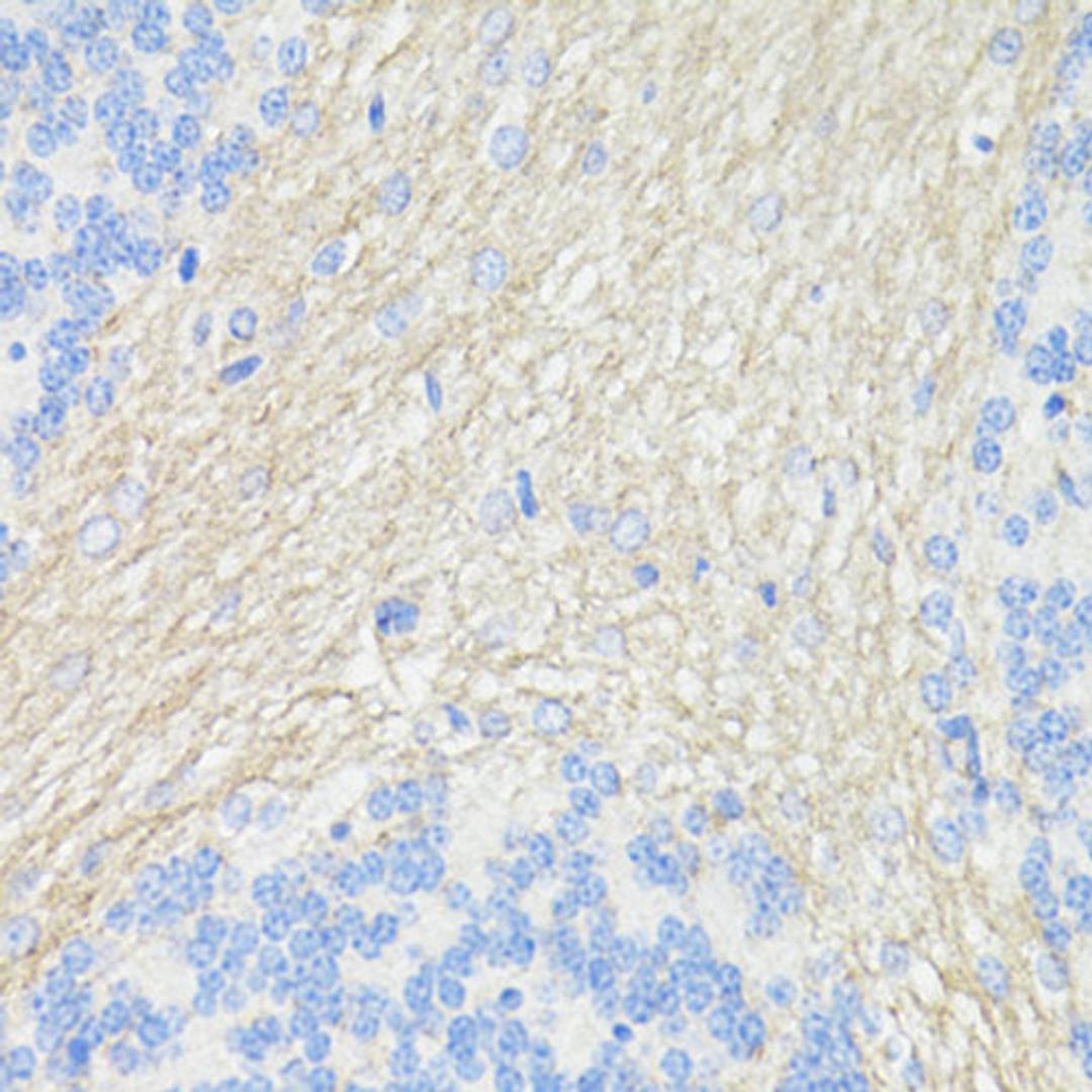 Immunohistochemistry  - THY1 antibody (A16986)