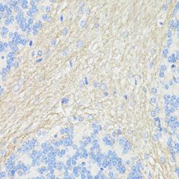 Immunohistochemistry  - THY1 antibody (A16986)