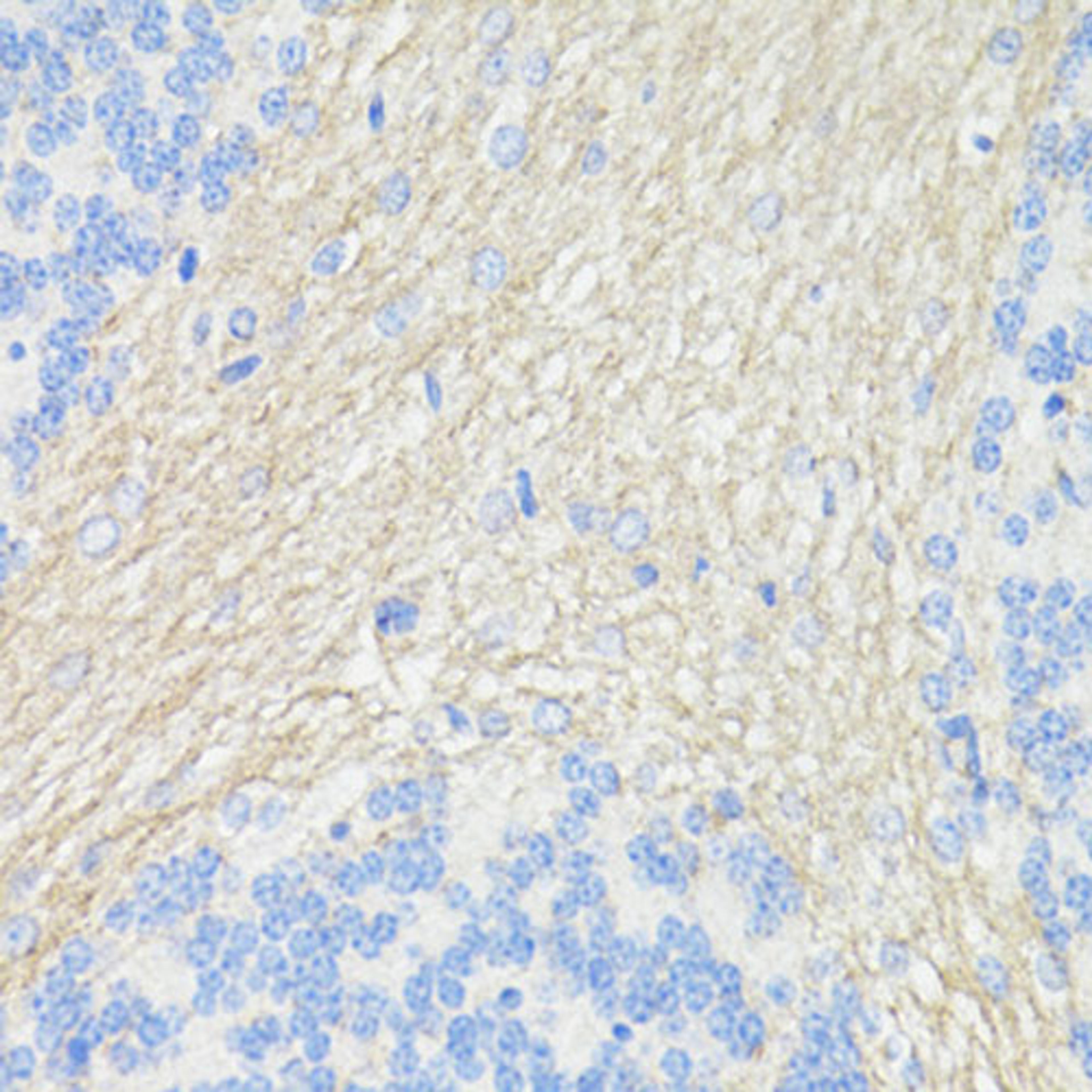 Immunohistochemistry  - THY1 antibody (A16986)