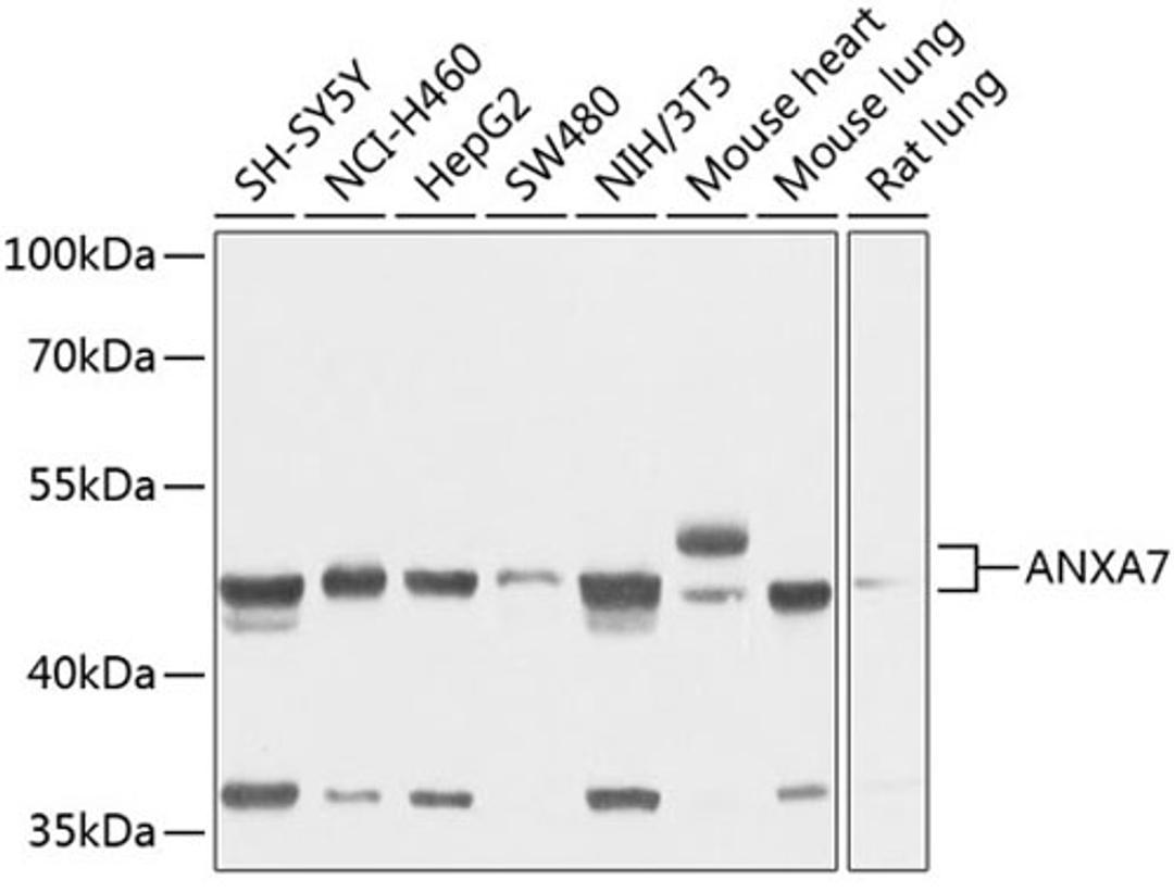 Western blot - ANXA7 antibody (A3733)