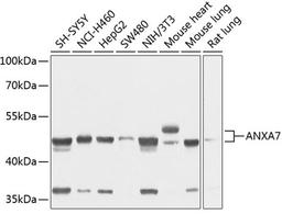 Western blot - ANXA7 antibody (A3733)