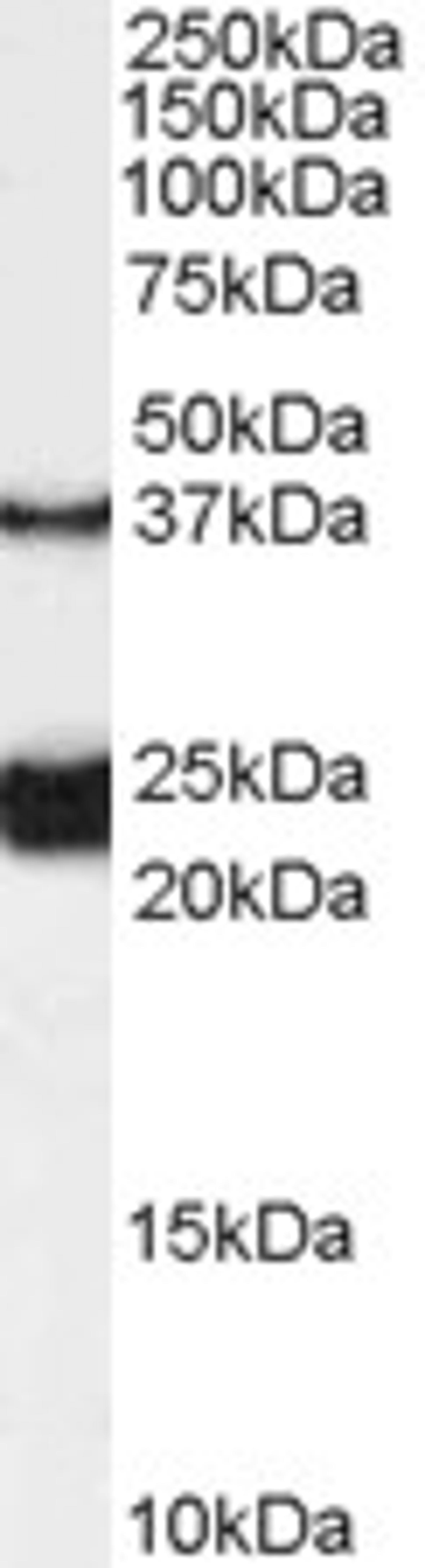 45-653 (0.1ug/ml) staining of Rat Spinal Cord lysate (35ug protein in RIPA buffer). Primary incubation was 1 hour. Detected by chemiluminescence.