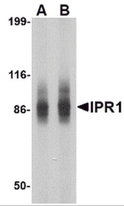 Western blot analysis of IPR1 in SW480 cell lysate with IPR1 antibody at (A) 1 and (B) 2 &#956;g/mL.