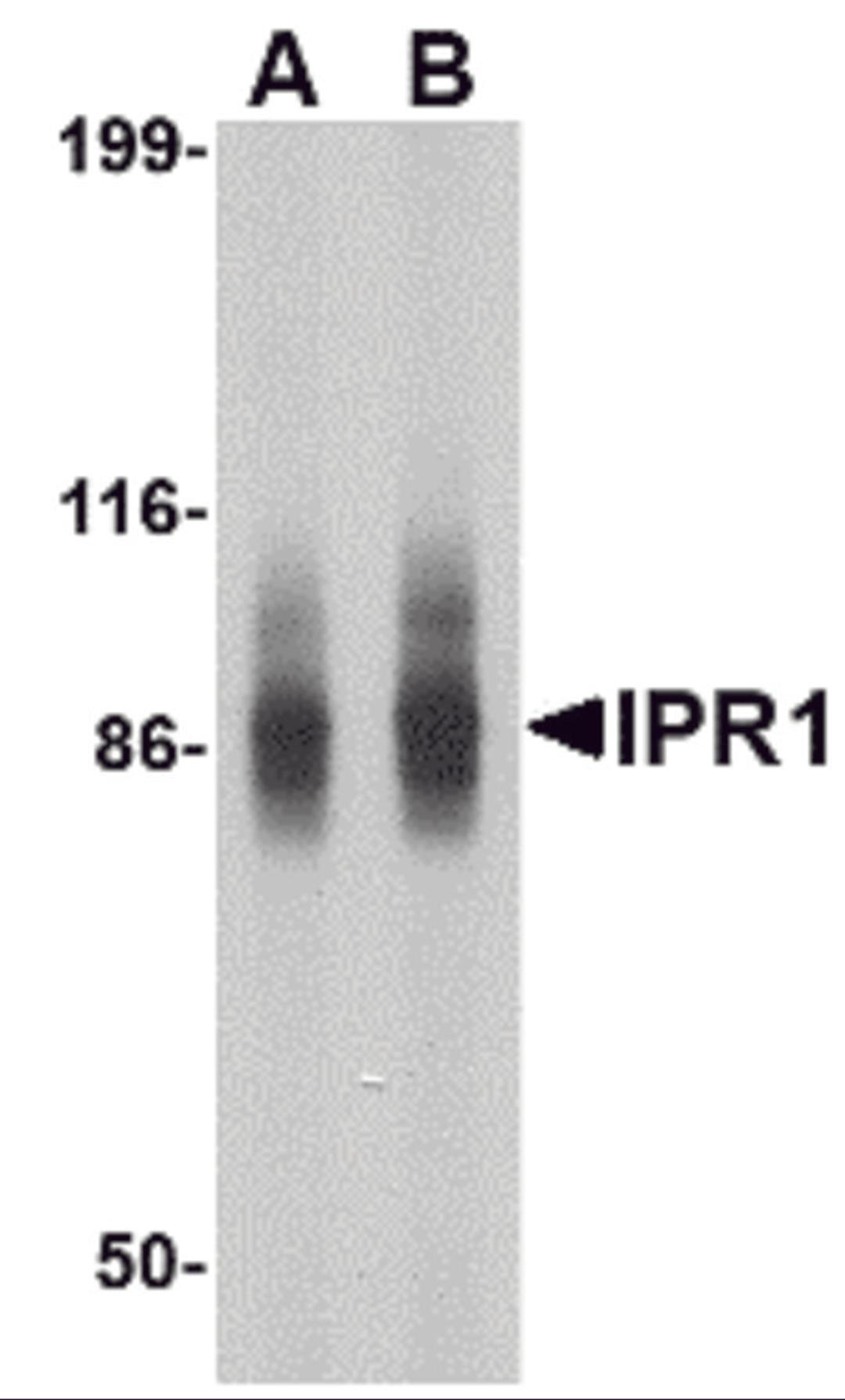 Western blot analysis of IPR1 in SW480 cell lysate with IPR1 antibody at (A) 1 and (B) 2 μg/mL.