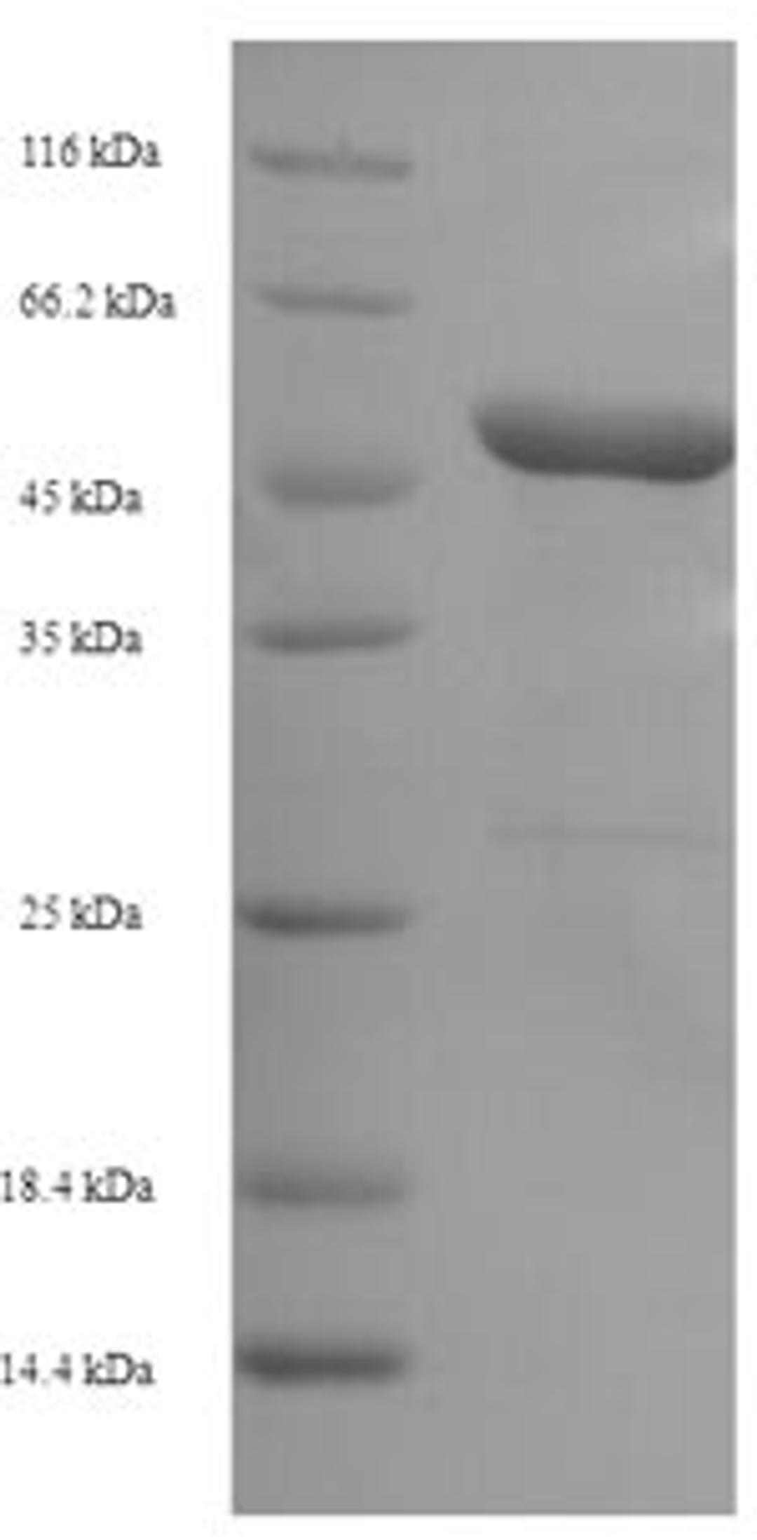 (Tris-Glycine gel) Discontinuous SDS-PAGE (reduced) with 5% enrichment gel and 15% separation gel.