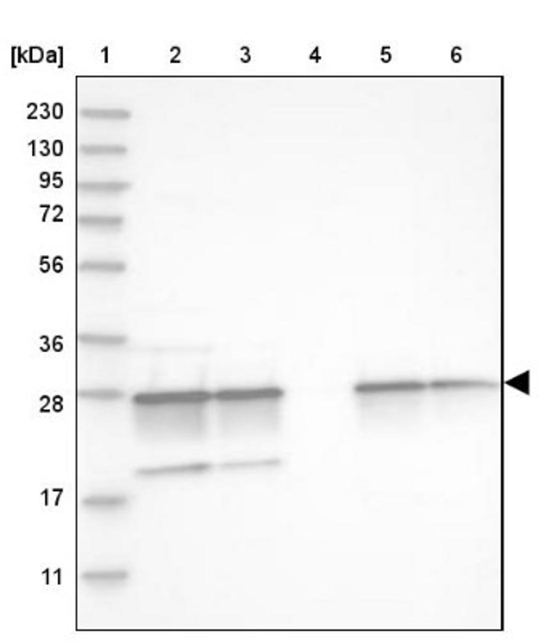 Western Blot: Proteasome 20S alpha 5 Antibody [NBP1-86838] - Lane 1: Marker [kDa] 230, 130, 95, 72, 56, 36, 28, 17, 11<br/>Lane 2: Human cell line RT-4<br/>Lane 3: Human cell line U-251MG sp<br/>Lane 4: Human plasma (IgG/HSA depleted)<br/>Lane 5: Human liver tissue<br/>Lane 6: Human tonsil tissue