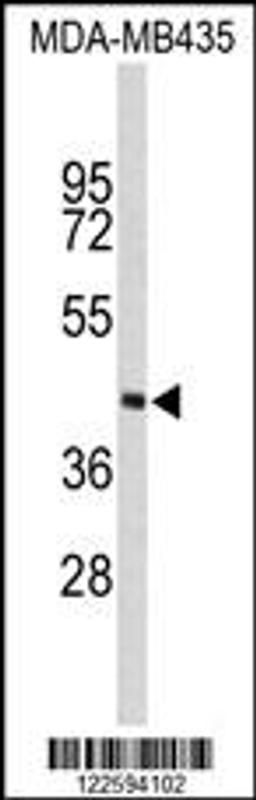 Western blot analysis of PHYH Antibody in MDA-MB435 cell line lysates (35ug/lane)