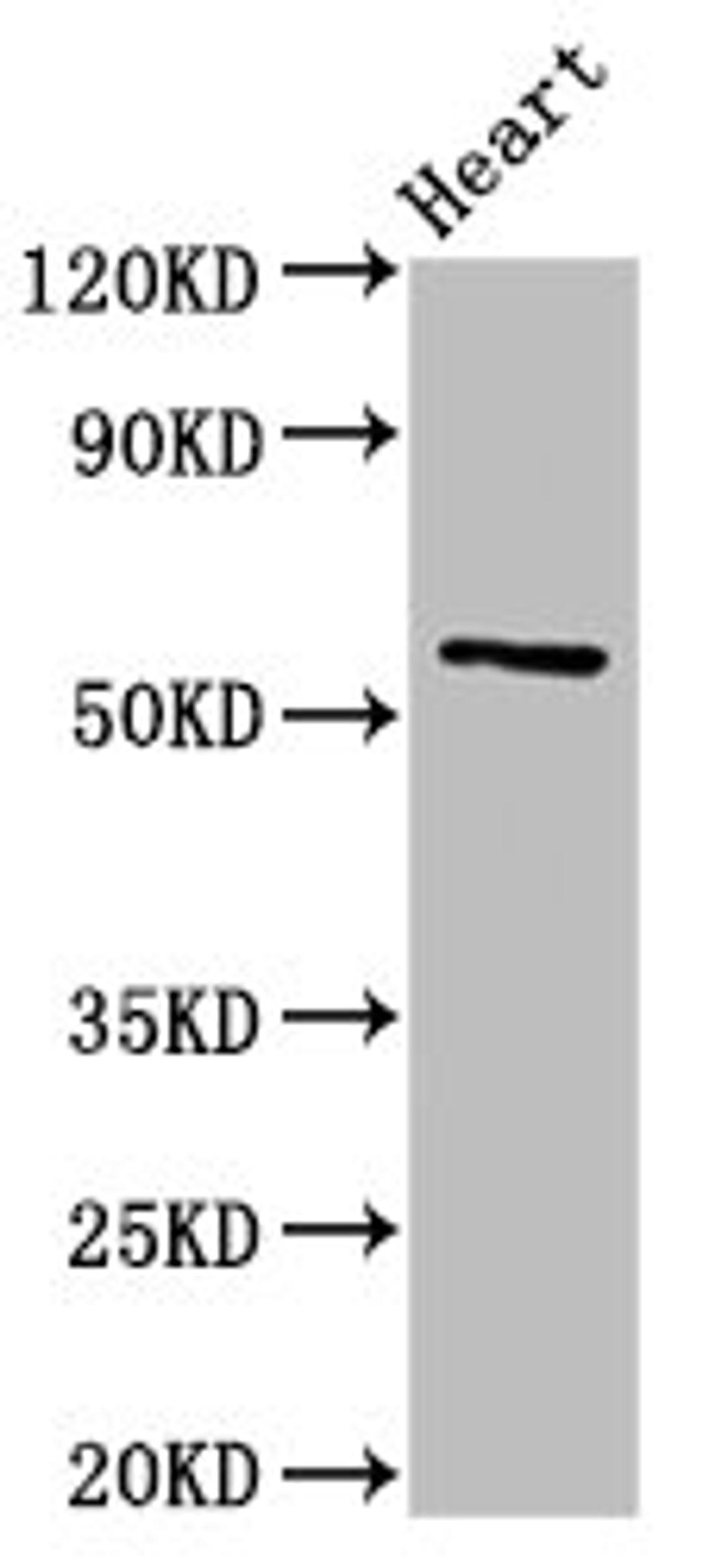 Western Blot. Positive WB detected in: Rat heart tissue. All lanes: CYP2A6 antibody at 3ug/ml. Secondary. Goat polyclonal to rabbit IgG at 1/50000 dilution. Predicted band size: 57 kDa. Observed band size: 57 kDa. 