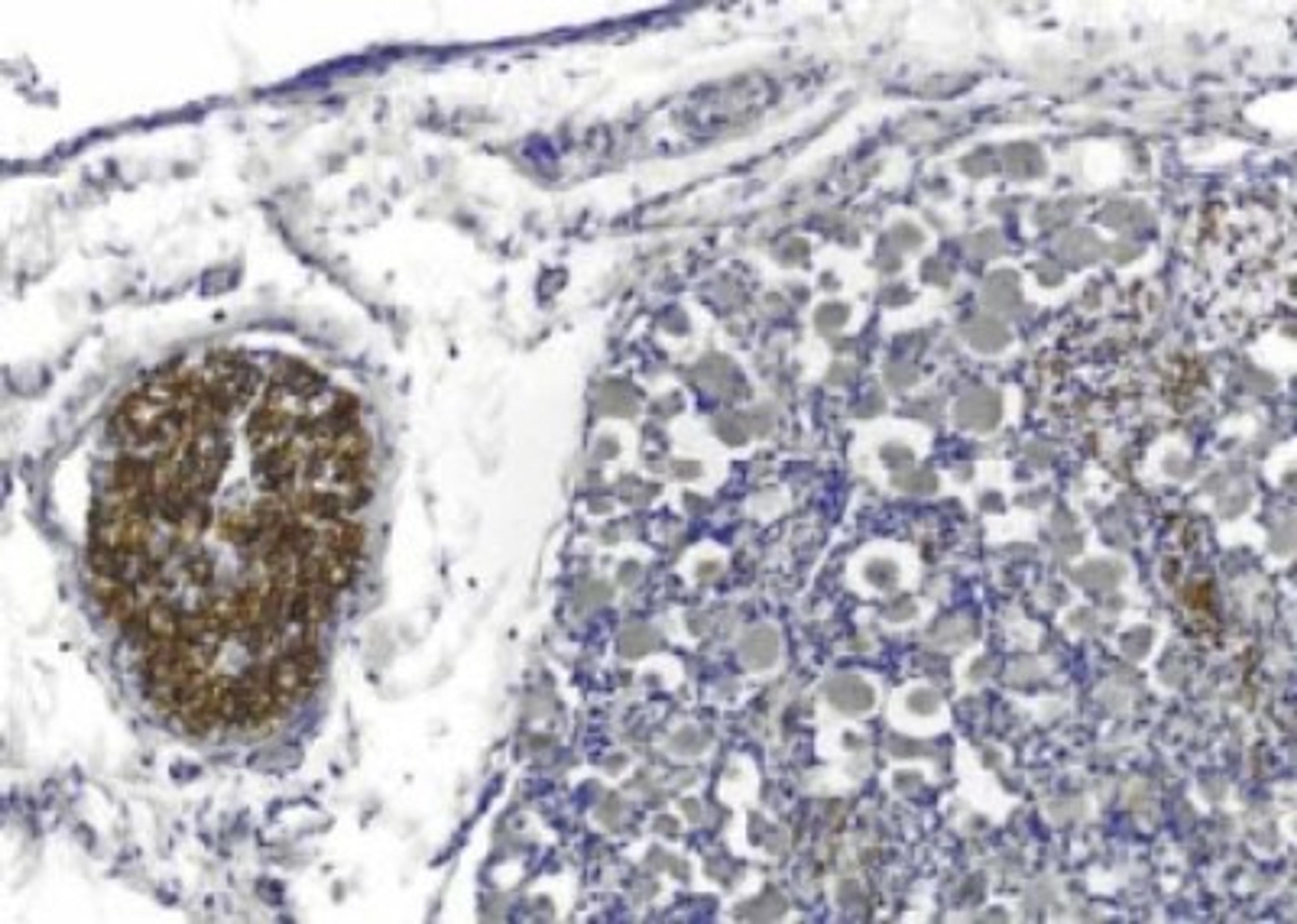 Immunohistochemistry: PMP22 Antibody (Hu1) [NB110-59086] - Staining of PMP22 (brown) in dorsal root ganglion and spinal roots in 20 week fetal spinal cord preparation from rhesus monkey.