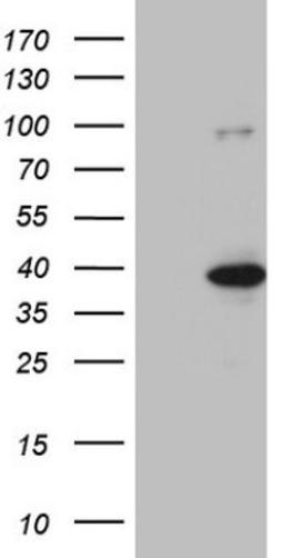 Western Blot: KLF9 Antibody (8A11) [NBP2-45511] - Analysis of HEK293T cells were transfected with the pCMV6-ENTRY control (Left lane) or pCMV6-ENTRY KLF9.