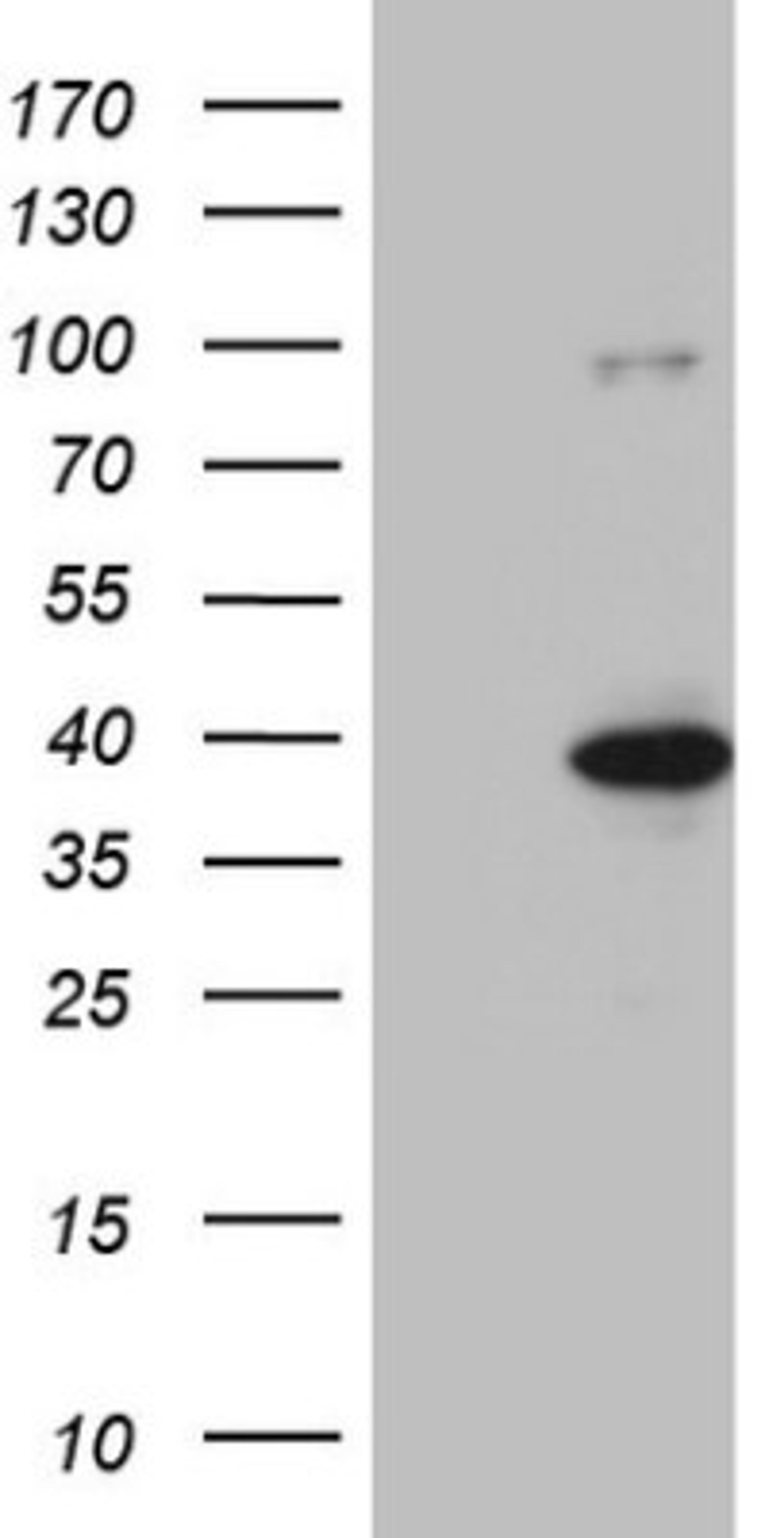 Western Blot: KLF9 Antibody (8A11) [NBP2-45511] - Analysis of HEK293T cells were transfected with the pCMV6-ENTRY control (Left lane) or pCMV6-ENTRY KLF9.