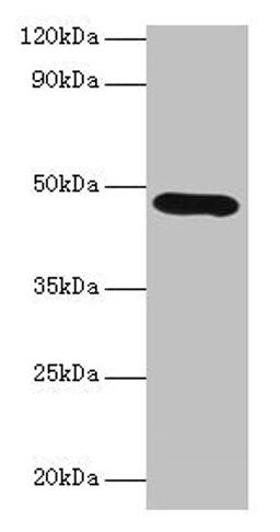 Western blot. All lanes: Lox antibody at 2µg/ml + K562 whole cell lysate. Secondary. Goat polyclonal to rabbit IgG at 1/10000 dilution. Predicted band size: 47 kDa. Observed band size: 47 kDa