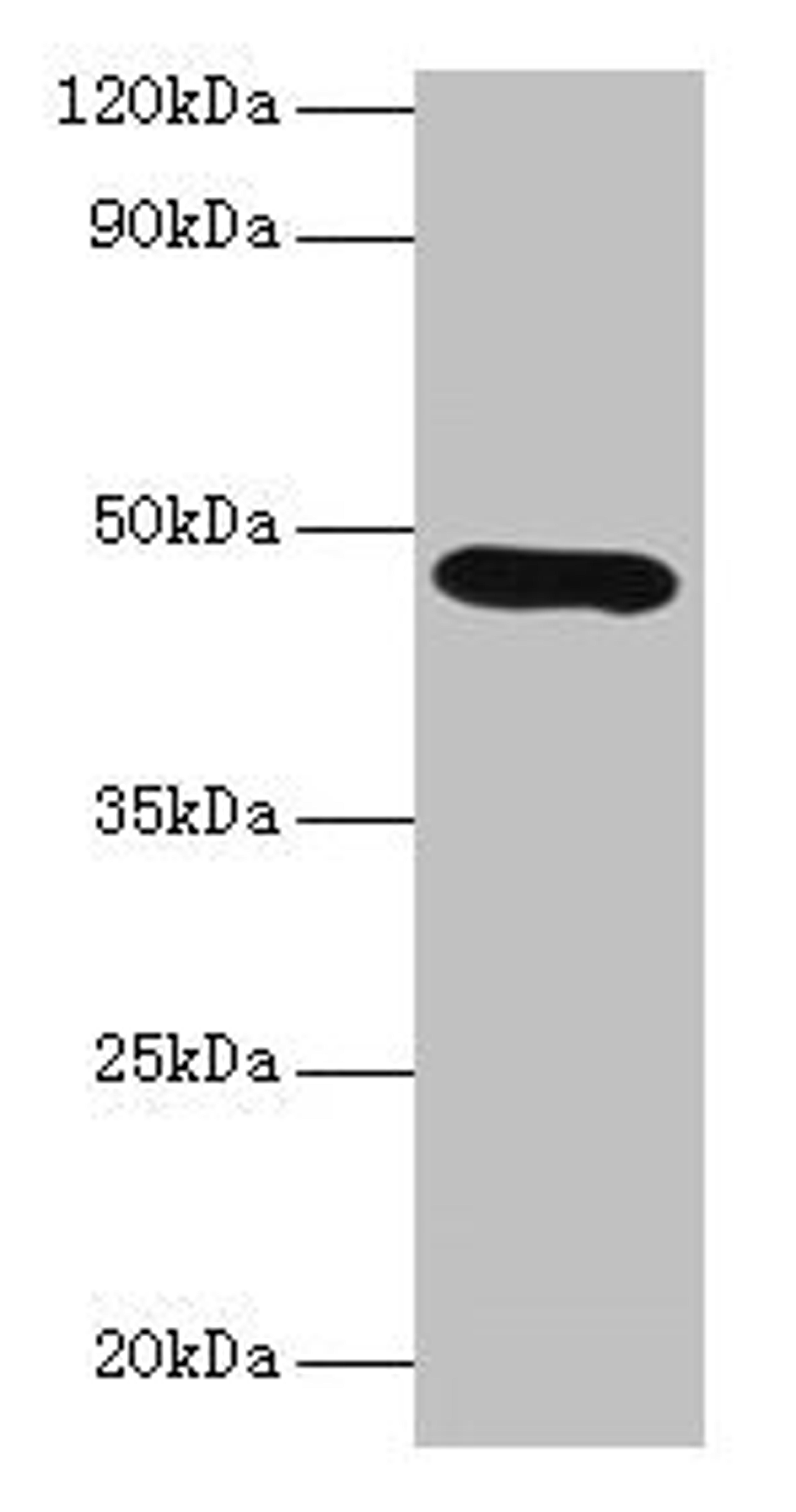 Western blot. All lanes: Lox antibody at 2µg/ml + K562 whole cell lysate. Secondary. Goat polyclonal to rabbit IgG at 1/10000 dilution. Predicted band size: 47 kDa. Observed band size: 47 kDa