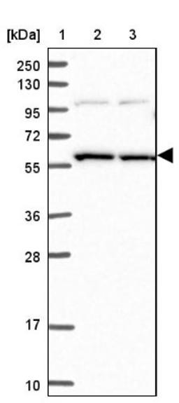 Western Blot: SNX17 Antibody [NBP1-92417] - Lane 1: Marker [kDa] 250, 130, 95, 72, 55, 36, 28, 17, 10<br/>Lane 2: Human cell line RT-4<br/>Lane 3: Human cell line U-251MG sp