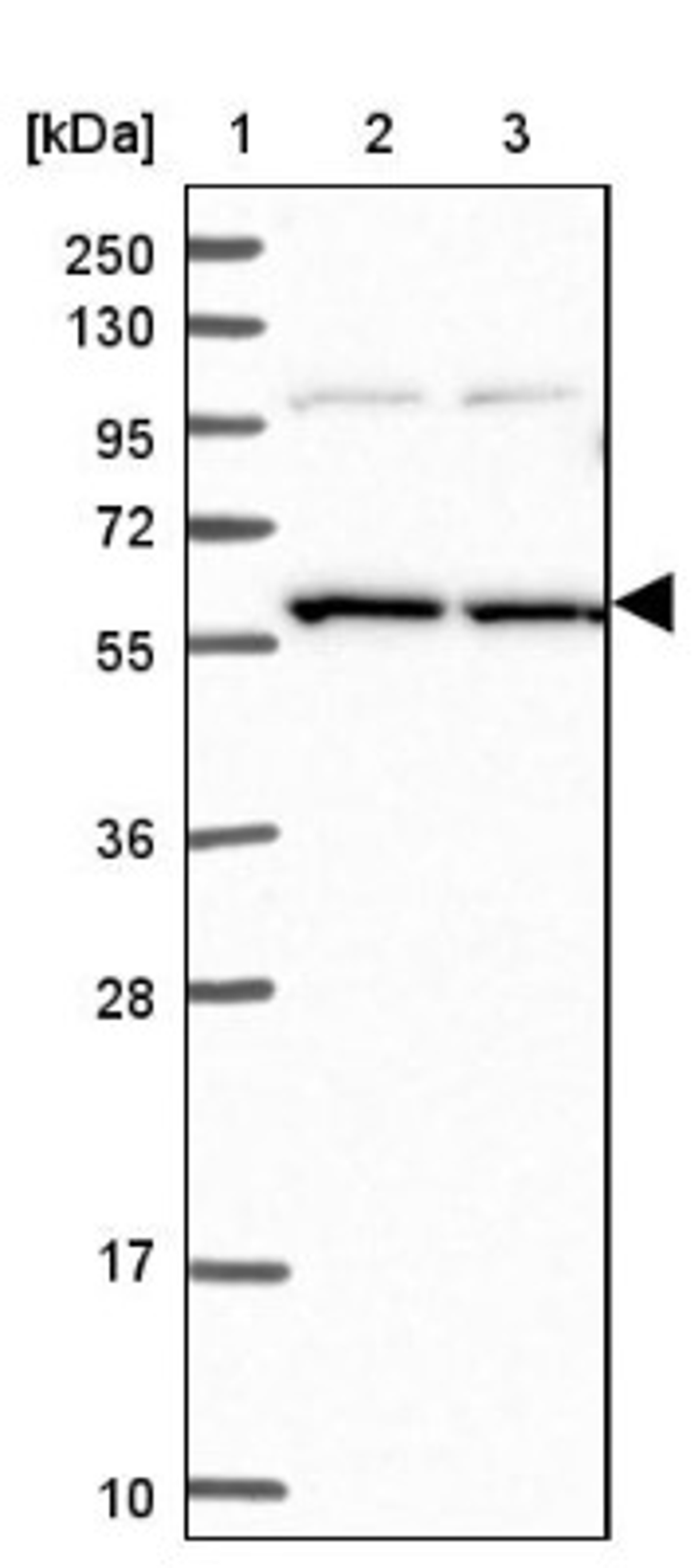 Western Blot: SNX17 Antibody [NBP1-92417] - Lane 1: Marker [kDa] 250, 130, 95, 72, 55, 36, 28, 17, 10<br/>Lane 2: Human cell line RT-4<br/>Lane 3: Human cell line U-251MG sp