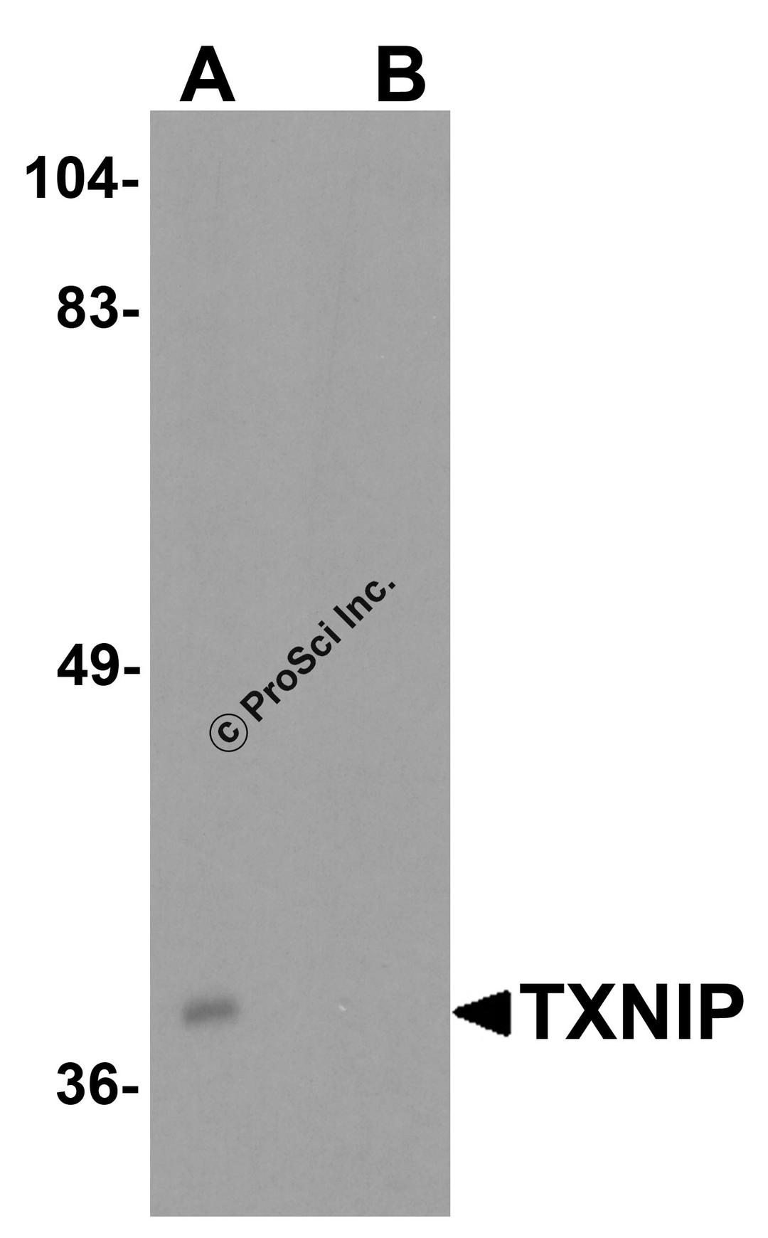 Western blot analysis of TXNIP in C2C12 cell lysate with TXNIP antibody at 0.5 μg/ml in (A) the absence and (B) the presence of blocking peptide.
