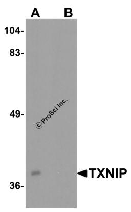 Western blot analysis of TXNIP in C2C12 cell lysate with TXNIP antibody at 0.5 μg/ml in (A) the absence and (B) the presence of blocking peptide.